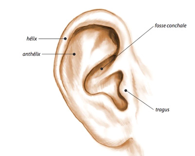 acouphènes oreille décollée